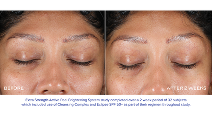 EXTRA STRENGTH ACTIVE PEEL BRIGHTENING SYSTEM