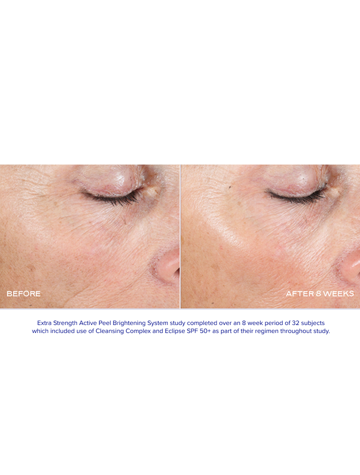 EXTRA STRENGTH ACTIVE PEEL BRIGHTENING SYSTEM
