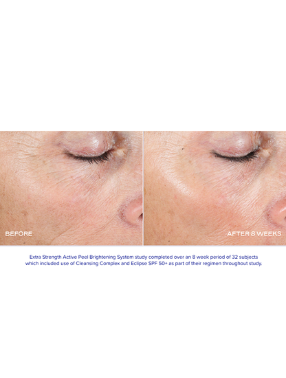 EXTRA STRENGTH ACTIVE PEEL BRIGHTENING SYSTEM